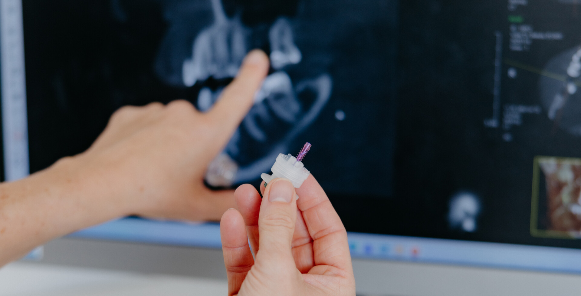 Dr. med. dent. Maren Seubert h&auml;lt ein Implantat in der Hand und erkl&auml;rt Patient:innen anhand eines R&ouml;ntgenbilds die pr&auml;zise Platzierung dessen.