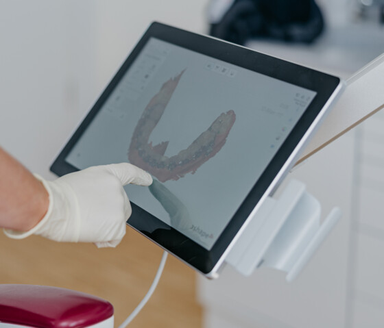 Behandschuhte Hand tippt auf Touchscreen mit digitalem 3D-Kieferscan.