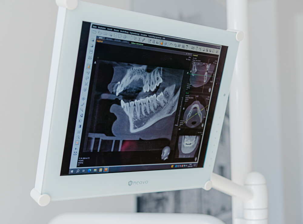 Medizinischer Monitor zeigt ein digitales R&ouml;ntgenbild des Kiefers und der Z&auml;hne in einer Analysesoftware.
