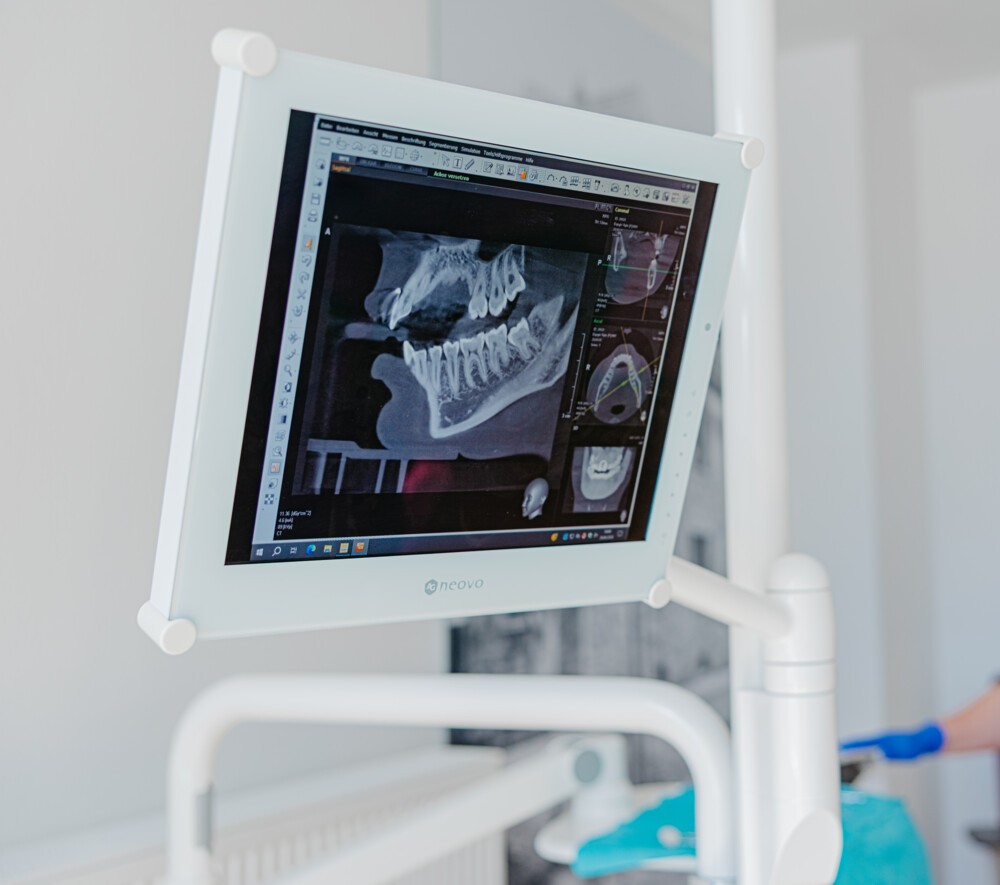 Wei&szlig;er medizinischer Monitor zeigt ein digitales 3D-R&ouml;ntgenbild von Kiefer und Z&auml;hnen in einer Analysesoftware.